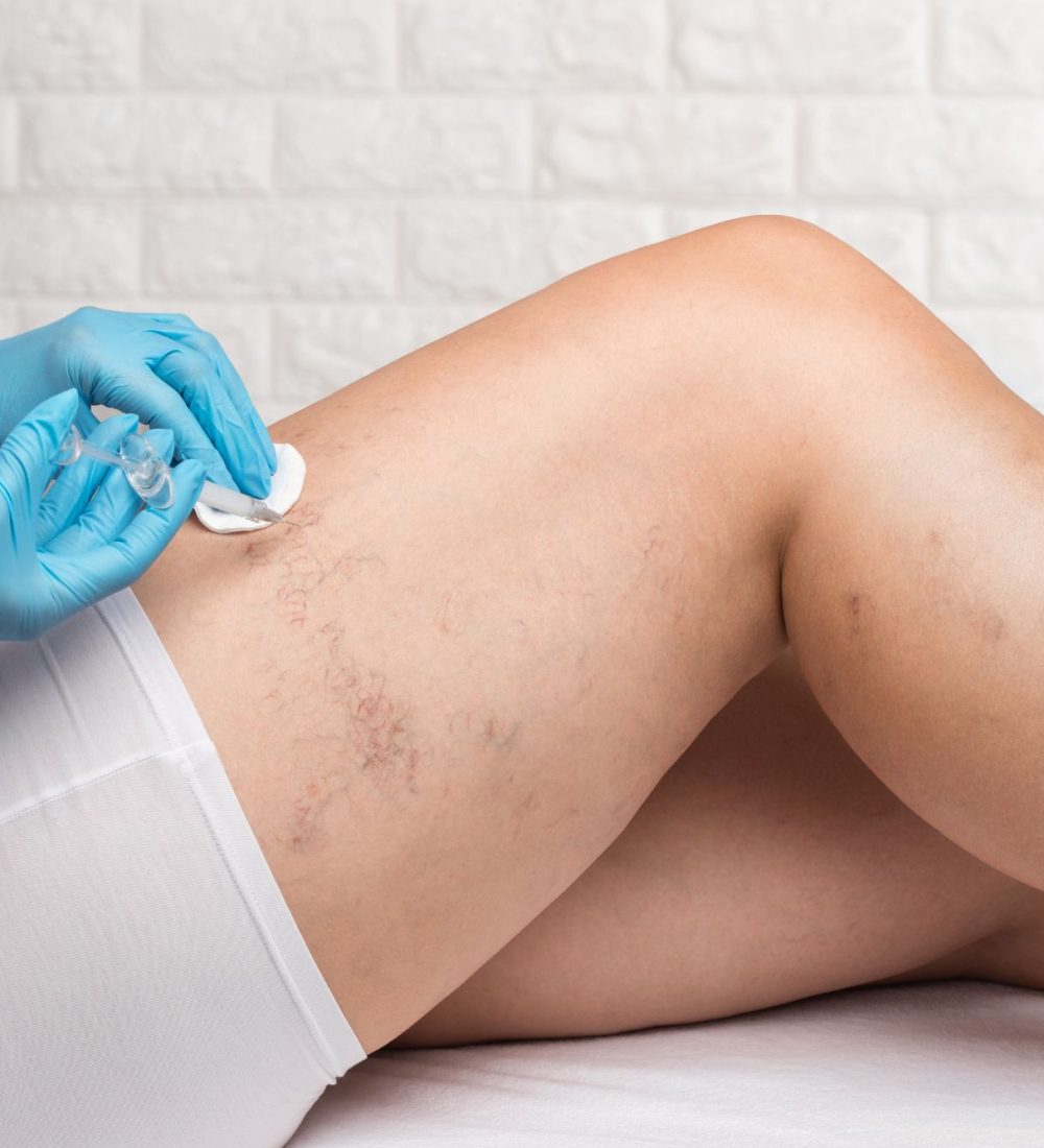 chirurgia-naczyniowa